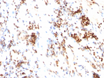 Anti-p27 Kip1 antibody [DCS-72.F6] used in IHC (Paraffin sections) (IHC-P). GTX34931