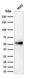 Anti-p53 antibody [SPM589] used in Western Blot (WB). GTX34932