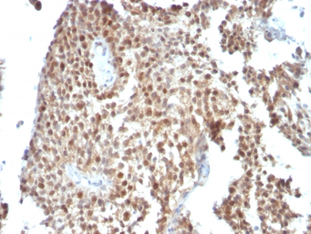 Anti-p53 antibody [SPM590] used in IHC (Paraffin sections) (IHC-P). GTX34933