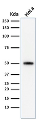 Anti-p53 antibody [SPM590] used in Western Blot (WB). GTX34933