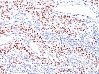 Anti-p53 antibody [TRP/816] used in IHC (Paraffin sections) (IHC-P). GTX34934