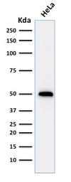 Anti-p53 antibody [TRP/816] used in Western Blot (WB). GTX34934