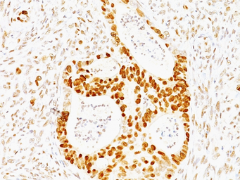 Anti-p53 antibody [TRP/817] used in IHC (Paraffin sections) (IHC-P). GTX34935