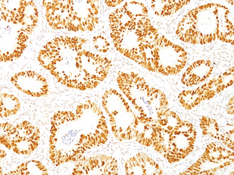 Anti-p53 antibody [DO-7] used in IHC (Paraffin sections) (IHC-P). GTX34938