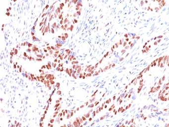 Anti-p57 Kip2 antibody [KIP2/880] used in IHC (Paraffin sections) (IHC-P). GTX34941