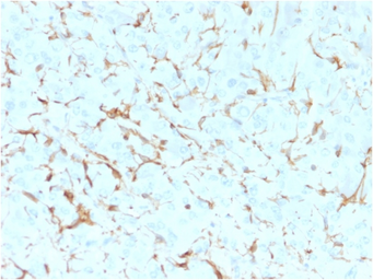 Anti-p75 NGF Receptor / CD271 antibody [NGFR5] used in IHC (Paraffin sections) (IHC-P). GTX34945