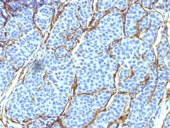Anti-p75 NGF Receptor / CD271 antibody [SPM299] used in IHC (Paraffin sections) (IHC-P). GTX34946