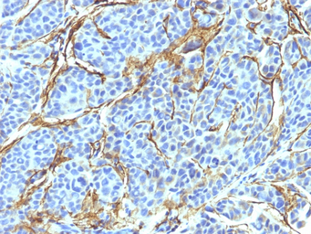 Anti-p75 NGF Receptor / CD271 antibody [NTR/912] used in IHC (Paraffin sections) (IHC-P). GTX34947