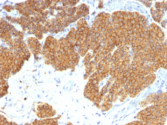 Anti-Parathyroid Hormone antibody [3H9] used in IHC (Paraffin sections) (IHC-P). GTX34948