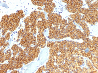 Anti-Parathyroid Hormone antibody [PTH/911] used in IHC (Paraffin sections) (IHC-P). GTX34949