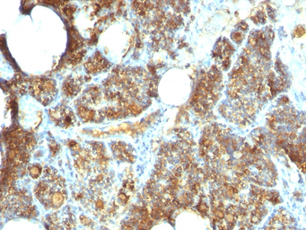 Anti-Parathyroid Hormone antibody [PTH/1173] used in IHC (Paraffin sections) (IHC-P). GTX34951