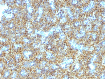 Anti-Parathyroid Hormone antibody [PTH/1174] used in IHC (Paraffin sections) (IHC-P). GTX34952