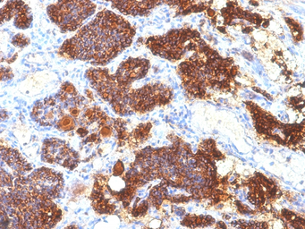 Anti-Parathyroid Hormone antibody [PTH/1175] used in IHC (Paraffin sections) (IHC-P). GTX34953