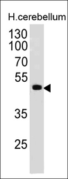 Anti-PAX6 antibody [PAX6/498] used in Western Blot (WB). GTX34955