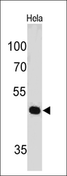Anti-PAX7 antibody [PAX7/497] used in Western Blot (WB). GTX34958