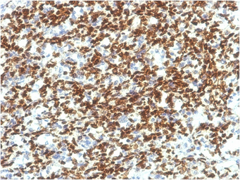 Anti-PAX7 antibody [PAX7/1187] used in IHC (Paraffin sections) (IHC-P). GTX34959