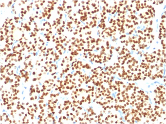 Anti-PAX8 antibody [PAX8/1491] used in IHC (Paraffin sections) (IHC-P). GTX34961
