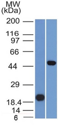 Anti-PAX8 antibody [PAX8/1491] used in Western Blot (WB). GTX34961