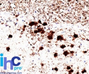Anti-PGP9.5 antibody [31A3] used in IHC (Paraffin sections) (IHC-P). GTX34969
