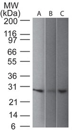 Anti-PGP9.5 antibody [31A3] used in Western Blot (WB). GTX34969