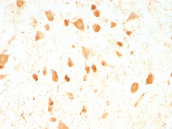 Anti-PGP9.5 antibody [UCHL1/775] used in IHC (Paraffin sections) (IHC-P). GTX34971