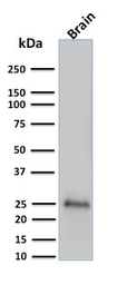 Anti-PGP9.5 antibody [UCHL1/775] used in Western Blot (WB). GTX34971