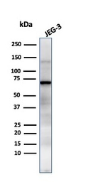 Anti-Placental Alkaline Phosphatase antibody [GM022] used in Western Blot (WB). GTX34974