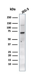 Anti-Placental Alkaline Phosphatase antibody [PL8-F6] used in Western Blot (WB). GTX34975