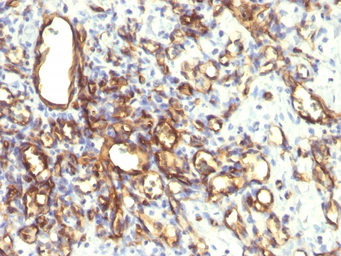 Anti-PODXL antibody [2A4] used in IHC (Paraffin sections) (IHC-P). GTX34979