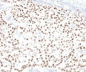 Anti-Progesterone Receptor antibody [PR484] used in IHC (Paraffin sections) (IHC-P). GTX34980