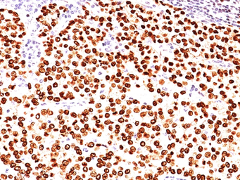 Anti-Progesterone Receptor antibody [SPM566] used in IHC (Paraffin sections) (IHC-P). GTX34981
