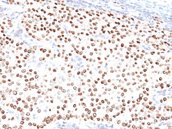 Anti-Progesterone Receptor antibody [PR500] used in IHC (Paraffin sections) (IHC-P). GTX34982