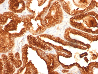 Anti-Prostatic Acid Phosphatase antibody [SPM312] used in IHC (Paraffin sections) (IHC-P). GTX34988