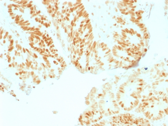 Anti-Rb antibody [RB1/1754] used in IHC (Paraffin sections) (IHC-P). GTX34995