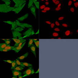 Anti-S100A4 antibody [S100A4/1481] used in Immunocytochemistry/ Immunofluorescence (ICC/IF). GTX34999