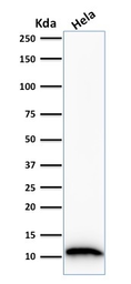 Anti-S100A4 antibody [S100A4/1481] used in Western Blot (WB). GTX34999