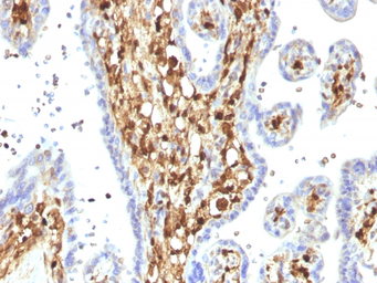 Anti-S100A4 antibody [S100A4/1482] used in IHC (Paraffin sections) (IHC-P). GTX35000