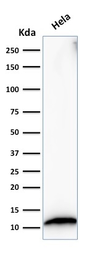 Anti-S100A4 antibody [S100A4/1482] used in Western Blot (WB). GTX35000
