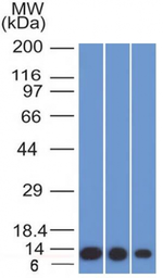 Anti-S100A4 antibody [S100A4/1482] used in Western Blot (WB). GTX35000