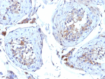 Anti-SHBG antibody [SHBG/245] used in IHC (Paraffin sections) (IHC-P). GTX35081