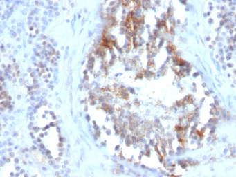 Anti-SHBG antibody [SPM605] used in IHC (Paraffin sections) (IHC-P). GTX35082