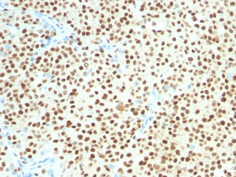Anti-SOX10 antibody [SOX10/1074] used in IHC (Paraffin sections) (IHC-P). GTX35084