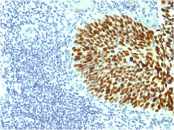 Anti-SOX2 antibody [SOX2/1791] used in IHC (Paraffin sections) (IHC-P). GTX35086