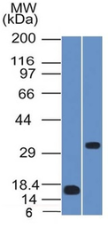 Anti-SOX2 antibody [SOX2/1791] used in Western Blot (WB). GTX35086