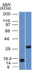 Anti-SOX2 antibody [SOX2/1792] used in Western Blot (WB). GTX35087