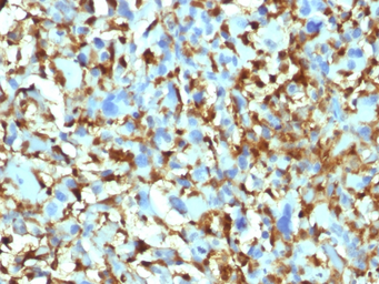 Anti-SPTBN2 antibody [SPTBN2/1582] used in IHC (Paraffin sections) (IHC-P). GTX35089