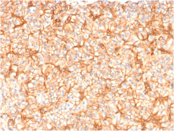 Anti-SPTBN2 antibody [SPTBN2/1582] used in IHC (Paraffin sections) (IHC-P). GTX35089
