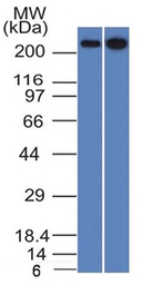 Anti-SPTBN2 antibody [SPTBN2/1582] used in Western Blot (WB). GTX35089