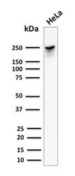 Anti-SPTBN2 antibody [SPTBN2/1582] used in Western Blot (WB). GTX35089