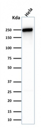 Anti-SPTBN2 antibody [SPTBN2/1583] used in Western Blot (WB). GTX35090
